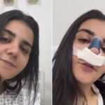 Após cirurgia, Yasmin Santos mostra resultado e celebra nova fase: “Fiz por mim”